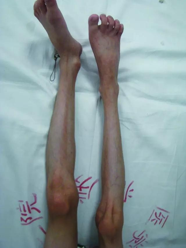 Xót xa cô bé 11 tuổi sống với ngoại hình của cụ bà 80 ảnh 2