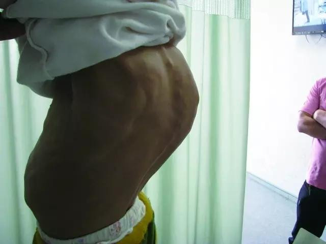 Xót xa cô bé 11 tuổi sống với ngoại hình của cụ bà 80 ảnh 1