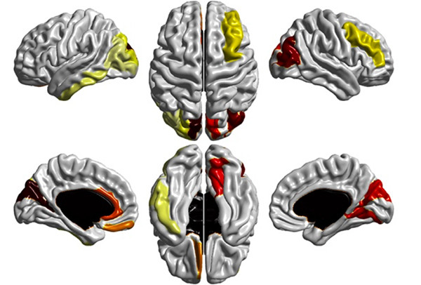 Phát hiện mới về phương pháp chẩn đoán sớm chứng tự kỷ ảnh 2