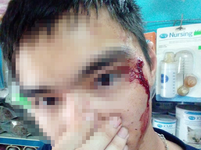 Hà Nội: Nghi vấn tài xế Grab đánh người vì không nhường đường ảnh 1