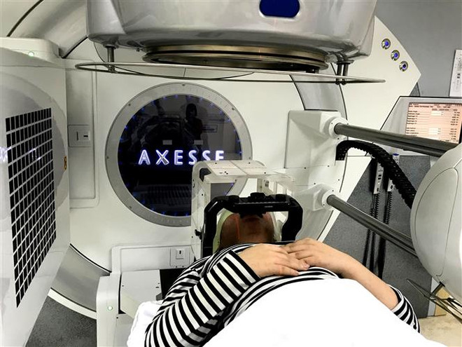 Kỹ thuật xạ phẫu điều trị thành công bệnh nhi động kinh kháng thuốc ảnh 1