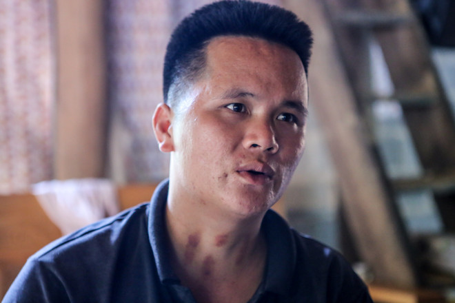 Hiểm họa khôn lường từ những quả "bom đất" ở Lào Cai ảnh 3