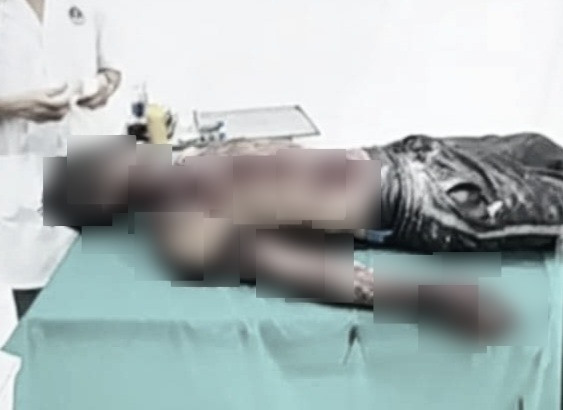 Thái Bình: Nổ bình ôxy sục hải sản, một người bị thương ảnh 1