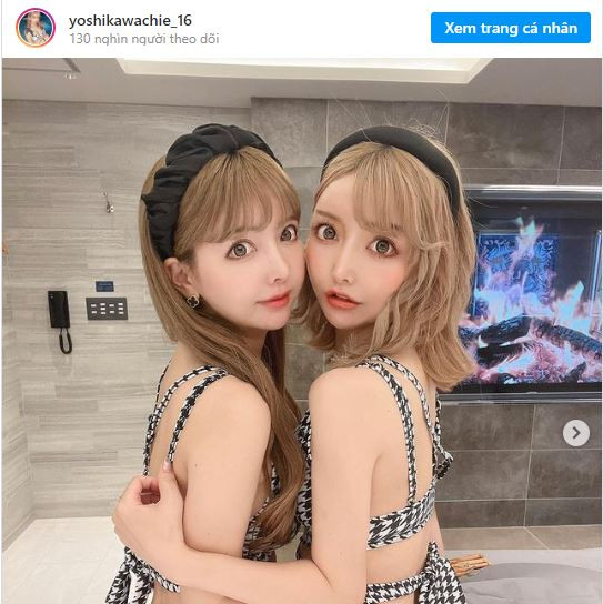 Hai chị em gây sốc vì phẫu thuật liên tục để có vẻ đẹp "vạn người mê" ảnh 3