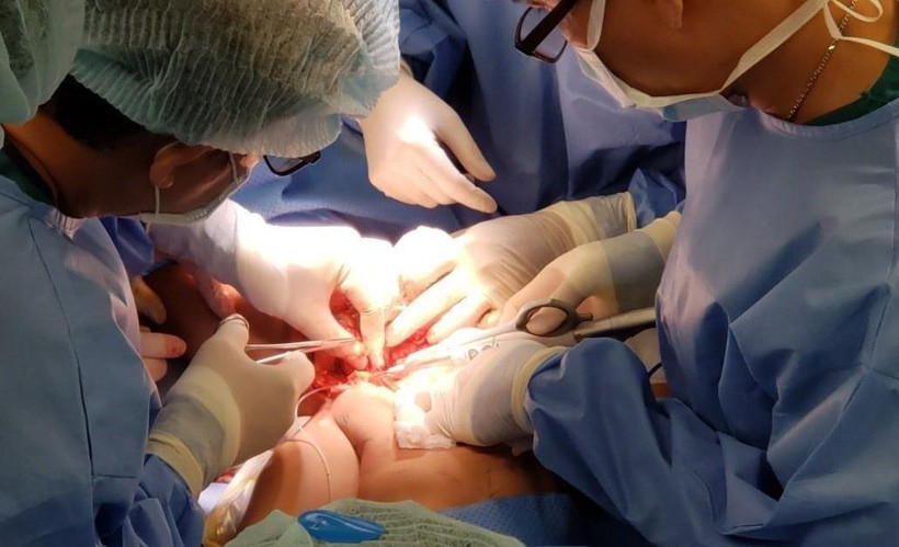 Các bác sỹ đang phẫu thuật tách rời hai bệnh nhi song sinh dính nhau. (Ảnh: TTXVN phát)