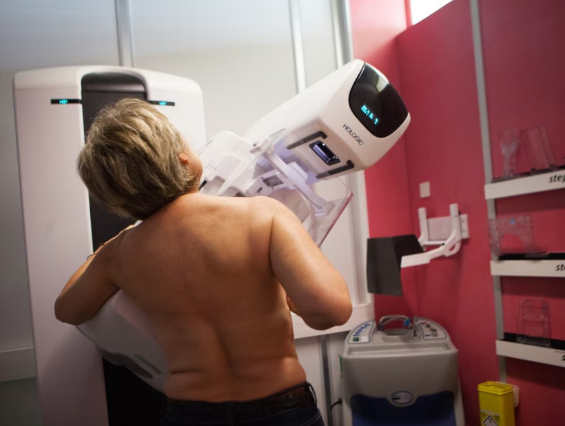 Mô ngực dày có thể khiến việc chụp chiếu, phát hiện ung thư vú trở nên khó khăn hơn. (Nguồn: National Geographic)