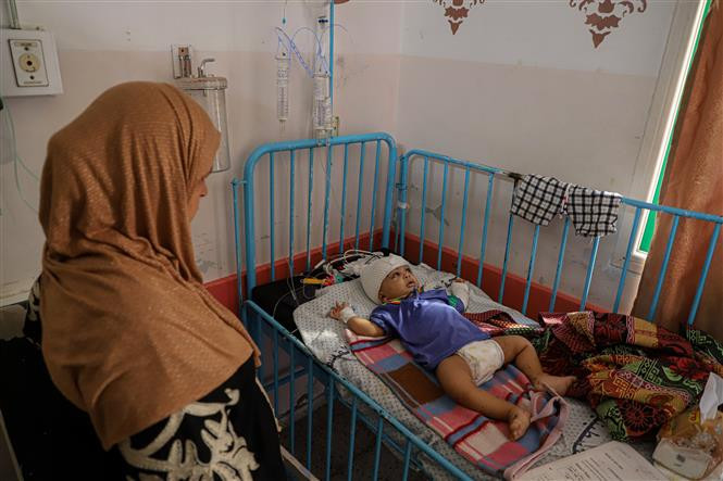 Em nhỏ bị thương do xung đột Israel-Hamas được điều trị tại Bệnh viện ở Khan Younis, Dải Gaza. (Ảnh: THX/TTXVN)