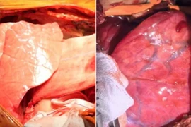 Ảnh chụp cho thấy phần phổi lợn ngay sau khi ghép tạng (trái) và 4 ngày sau. (Nguồn: CNN)