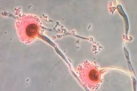 Nấm Aspergillus được cho là sẽ mở rộng phạm vi lây lan và ảnh hưởng khi Trái đất nóng lên. (Nguồn: CNN)