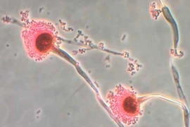 Nấm Aspergillus được cho là sẽ mở rộng phạm vi lây lan và ảnh hưởng khi Trái đất nóng lên. (Nguồn: CNN)