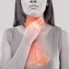 Triệu chứng ợ nóng do trào ngược dạ dày gây khó chịu. (Ảnh: iStock)