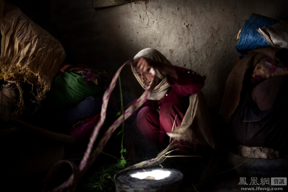 Một cô gái Pakistan bị tổn thương do axit. (Nguồn: ifeng.com)