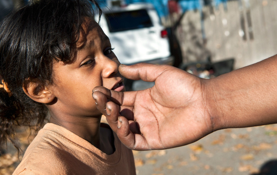 Khuôn mặt tội nghiệp của đứa trẻ nhà Jennifer. (Nguồn: ifeng.com)