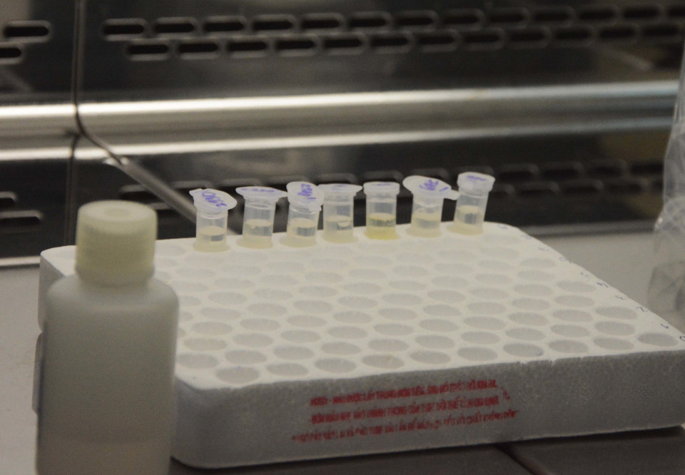 Cận cảnh các mẫu xét nghiệm dịch bệnh. (Ảnh: Văn Dũng/TTXVN)