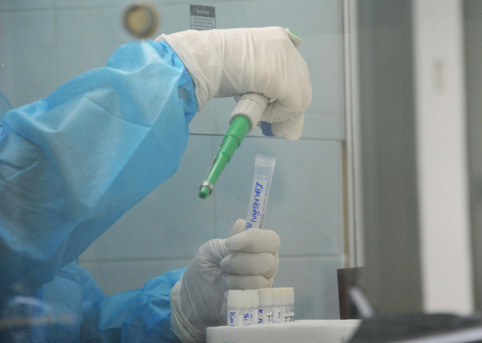 Cận cảnh công việc xét nghiệm của các y, bác sỹ. (Ảnh: Văn Dũng/TTXVN)