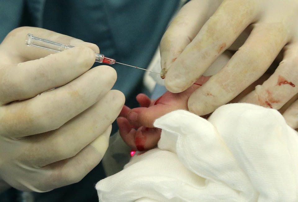 Bác sỹ tiến hành cấy gan cho cô bé. Đây là công đoạn quan trọng nhất của ca phẫu thuật. Mạch máu trong gan của em bé rất nhỏ nên phải vô cùng thận trọng khi khâu nối mạch máu, không thể để xảy ra bất kỳ thiếu sót nào. Các bác sỹ thay nhau thực hiện và sau 5 giờ đồng hồ, công đoạn cấy gan đã hoàn thành. (Nguồn: QQ)