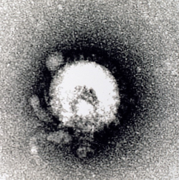 Tất cả các bệnh truyền nhiễm mới nổi đến nay, Việt Nam đều có khả năng xét nghiệm và phát hiện từ virus H5N1, Ebola, Corona mới... Trong ảnh: Viện Vệ sinh dịch tễ Trung ương thành công khi chụp ảnh được cấu trúc của Virus H5N1 bằng kính hiển vi điện tử JEM 1010 (2004). (Ảnh: Hữu Oãi/TTXVN)