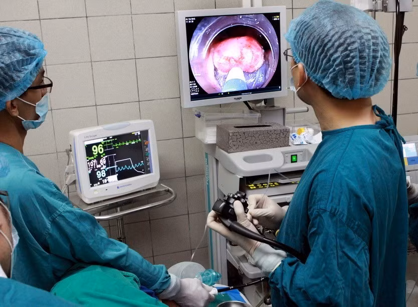 Nhiều kỹ thuật chuyên môn cao được thực hiện thành công tại nhiều bệnh viện trung ương như ghép tạng, nội soi, phẫu thuật bằng robot, chuyển giao một số kỹ thuật cho bệnh viện tuyến tỉnh, huyện... Trong ảnh: Kỹ thuật cắt tách dưới niêm mạc – thành tựu khoa học tiến bộ mới trong chẩn đoán, điều trị và tầm soát ung thư bệnh lý tiêu hóa của Trung tâm Tiêu hóa - Bệnh viện Bạch Mai. (Ảnh: Dương Ngọc/TTXVN)