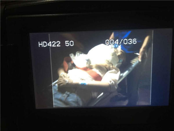 ...nhưng bác sỹ nói tim ngừng đập trước khi đến bệnh viện. (Nguồn: QQ)