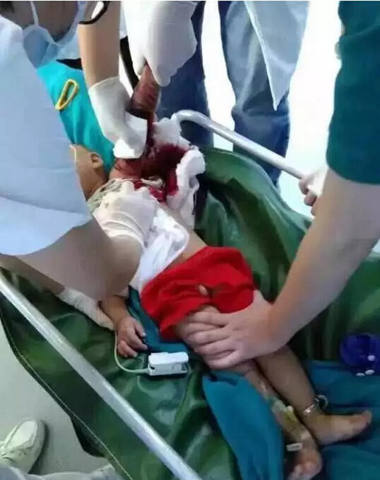 Bác sỹ đang cấp cứu cho cậu bé với cánh tay đầy máu. (Nguồn: QQ)