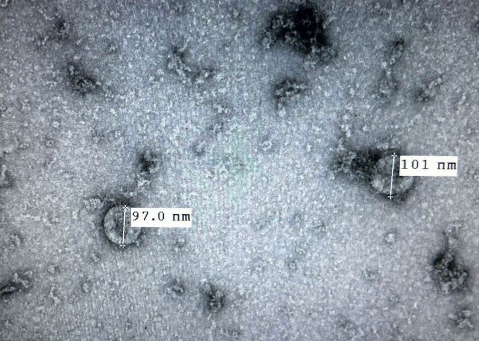 Ngày 7/2/2020, Viện Vệ sinh dịch tễ Trung ương công bố đã nuôi cấy và phân lập thành công chủng virus corona mới (nCoV) gây dịch viêm đường hô hấp cấp (COVID-19), tạo điều kiện cho việc xét nghiệm các trường hợp nhiễm và nghi nhiễm nCoV. Đây là tiền đề cho việc nghiên cứu và phát triển vắc xin phòng, chống loại virus này trong tương lai. (Nguồn: TTXVN)