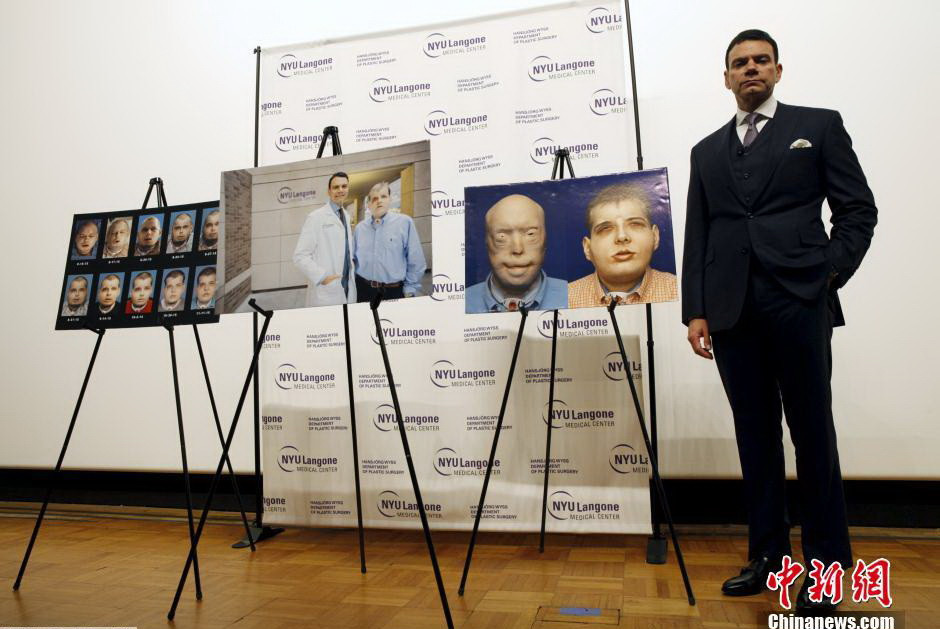 Eduardo D. Rodriguez trình bày thành quả của cuộc phẫu thuật. (Nguồn: Chinanews.com)