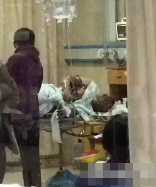 La đã bị bỏng nặng sau hành động dại dột trên. (Nguồn: china.com.cn)