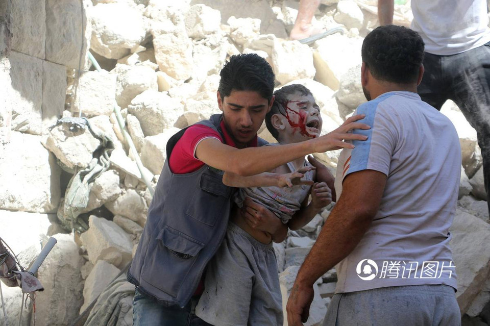 Em bé với khuôn mặt đầy máu.