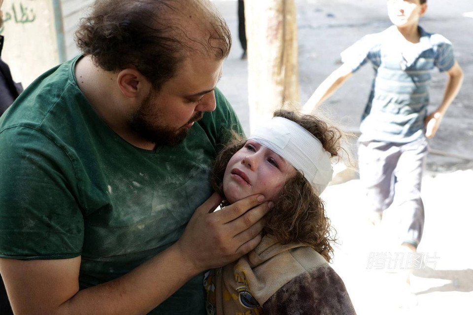 Bé gái bị thương trên đầu.