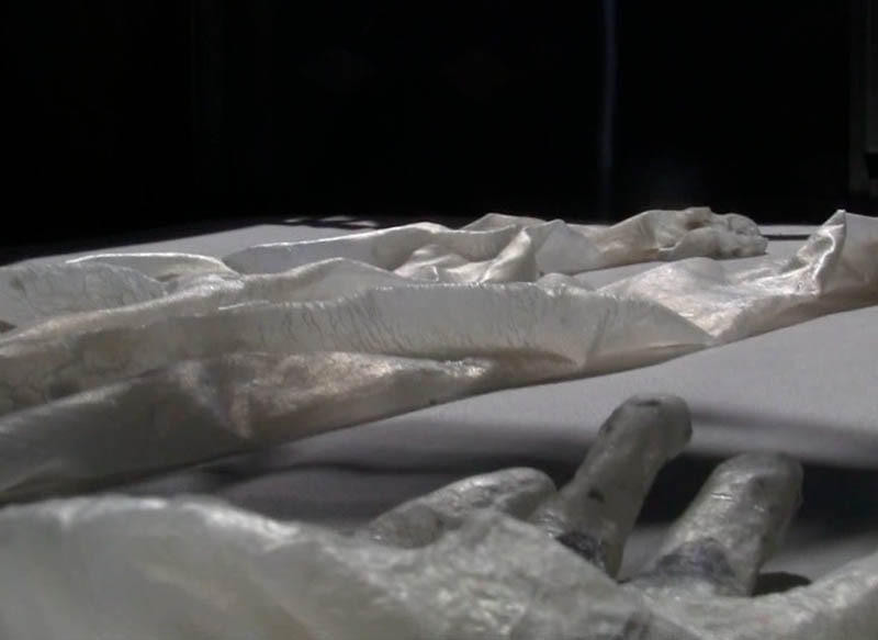 Nếp nhăn trên tay cũng được in rõ nét trên 'mảng da lột.' (Nguồn: QQ)