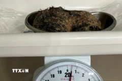 Búi tóc được gắp ra từ dạ dày bệnh nhi. (Ảnh: TTXVN phát)