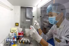 Phòng thí nghiệm Công nghệ Sinh học của Trường Đại học Quốc tế, Đại học Quốc gia Thành phố Hồ Chí Minh thực hiện nhiều nghiên cứu chuyên sâu, kỹ thuật nguồn trên thế giới. (Ảnh: Thanh Vũ/TTXVN)
