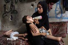 Trẻ em Palestine tại Dải Gaza bị suy dinh dưỡng. (Ảnh: THX/TTXVN)