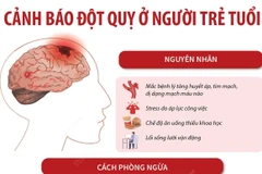 Tình trạng đột quỵ ở người trẻ tuổi đang trở nên đáng báo động