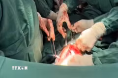 Các y, bác sỹ Bệnh viện đa khoa Bạc Liêu phẫu thuật khâu vết thương tâm thất trái, xử lý nhu mô phổi bị thủng và dẫn lưu màng phổi nhằm giữ lại sự sống cho bệnh nhân L.T.Đ. (Ảnh: TTXVN phát)