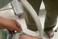 Thương tích trên người bé M.T. (Ảnh: PV/Vietnam+)