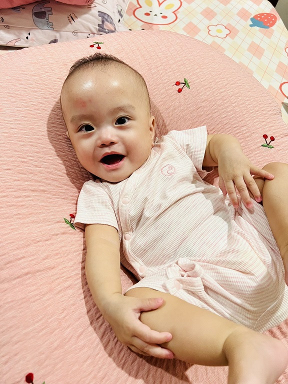 Bệnh viện Bạch Mai nuôi sống thành công trẻ sinh non nặng 400g ảnh 3