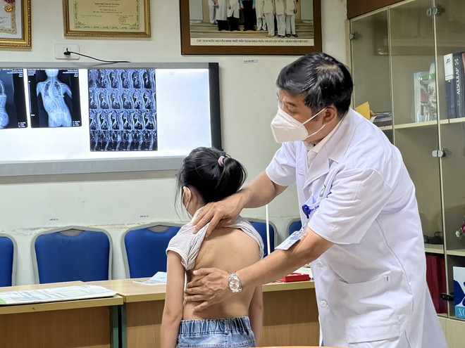 Dấu hiệu nhận biết và cách điều trị trẻ bị cong vẹo cột sống ảnh 1