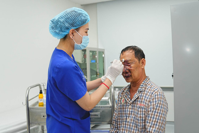 Phẫu thuật cắt khối u như chùm nho trên mặt một người đàn ông ảnh 1