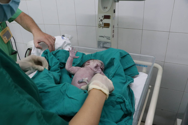 Kỳ tích cứu sống thai phụ vỡ tử cung ở tuần thứ 26 đặc biệt hi hữu ảnh 2