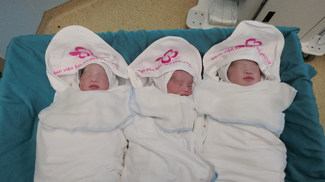 Phú Thọ: Mổ đẻ thành công cho sản phụ mang 3 thai tự nhiên hiếm gặp ảnh 1