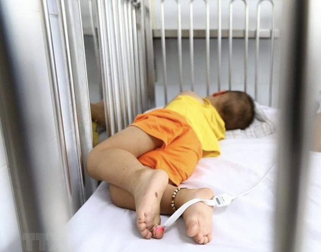 Số ca mắc tay chân miệng tăng nhanh, ghi nhận virus EV71 gây bệnh nặng ảnh 2