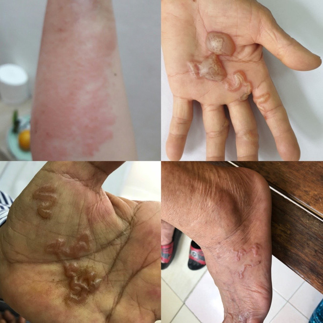 Nhiều bệnh nhân phát hiện nhiễm ký sinh trùng từ chó, mèo. (Ảnh: PV/Vietnam+) Cảnh báo nhiễm ký sinh trùng từ thú cưng nhưng lầm tưởng là dị ứng ảnh 4
