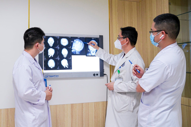 Tạo hình dạng hộp sọ cho bé gái bị dị dạng, đầu có hình tháp ảnh 1