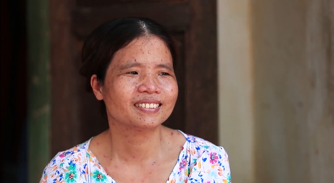 Chị Lê Thị Tình. (Ảnh: PV/Vietnam+) Nỗi đau khôn cùng của những người hít phải khói thuốc lá thụ động ảnh 2