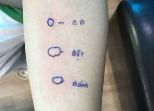 Một bệnh nhân bị sốc phản vệ với bột mì do hoạt động thể lực ảnh 1