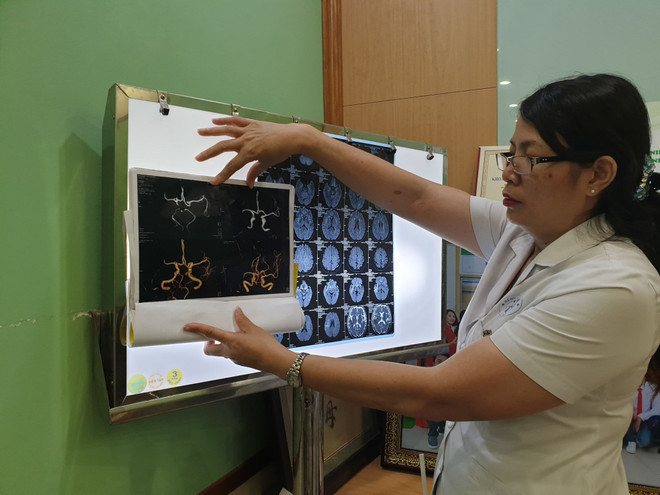 Tiến sỹ Nguyễn Thị Bảo Liên phân tích về những trường hợp bị bệnh đột quỵ. (Ảnh: T.G/Vietnam+) Những dấu hiệu không thể xem thường với các bệnh nhân bị đột quỵ ảnh 3