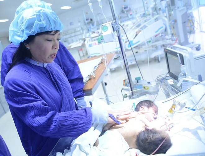 Sức khỏe của hai bé song sinh dính liền rất nguy kịch ảnh 2