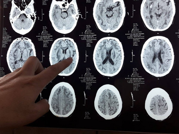 Rượu chứa Methanol: Loại “thuốc độc” vẫn ngang nhiên tung hoành ảnh 3