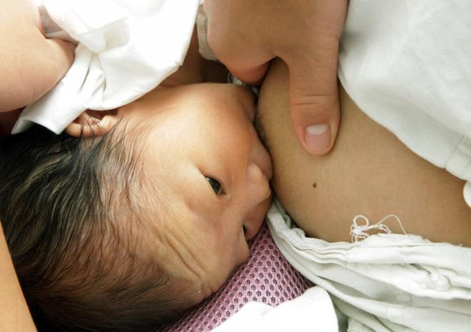 “Làm đẹp ngực: Chỉ nên tiến hành khi không có ý định sinh con nữa” ảnh 3